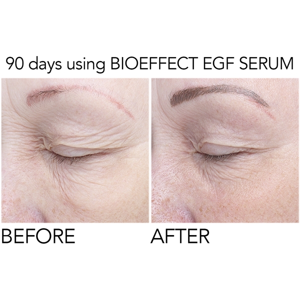 bioeffect egf serum recension