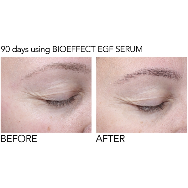 serum bioeffect egf