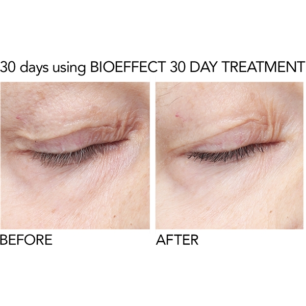 BioEffect EGF Eye Serum (Bild 4 av 10)