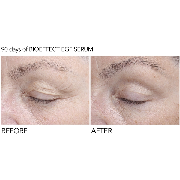 BioEffect EGF Eye Serum (Bild 5 av 10)