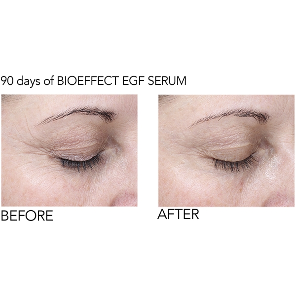 BioEffect EGF Eye Serum (Bild 6 av 10)