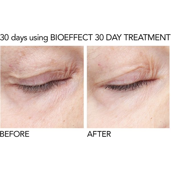 BioEffect 30 Day Treatment (Bild 4 av 8)