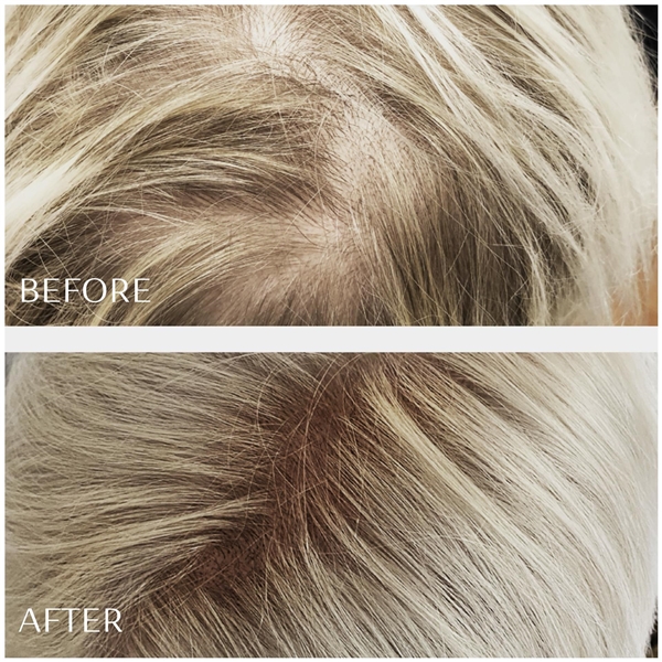 M2 Beauté Hair Activating Serum (Bild 2 av 5)