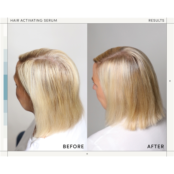 M2 Beauté Hair Activating Serum (Bild 4 av 5)