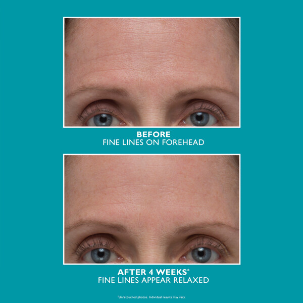 Peptide Skinjection Amplified Wrinkle Fix Serum (Bild 3 av 3)