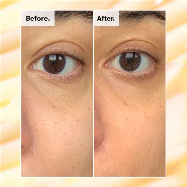 REN Radiance Brightening Dark Cicle Eye Cream (Bild 5 av 6)