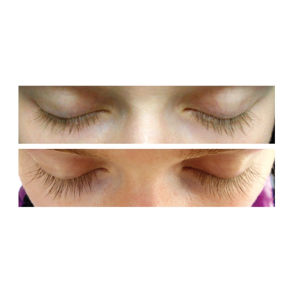 Xlash Eyelash Serum (Bild 2 av 2)